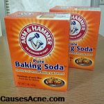 Baking Soda for acne