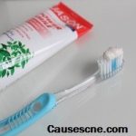 Toothpaste for acne